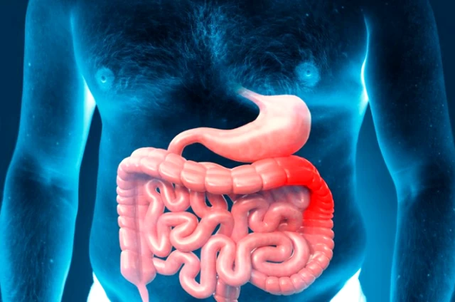 colon-cancer-part-1-incidence-symptoms-risk-factors-general